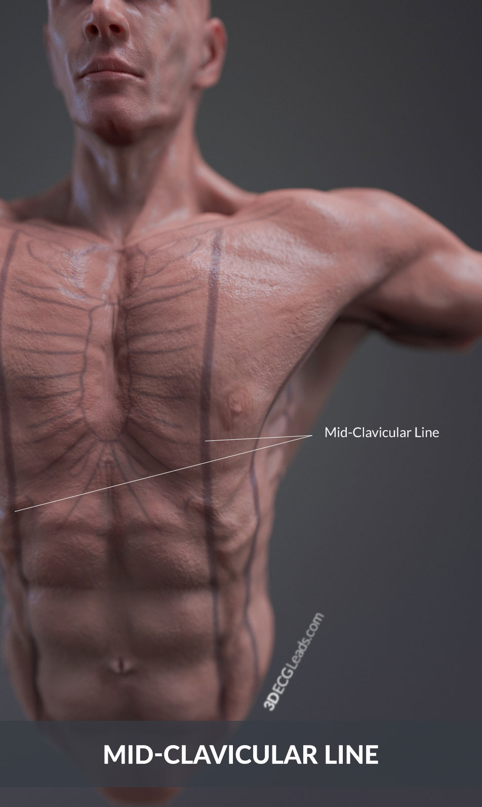 midclavicular line